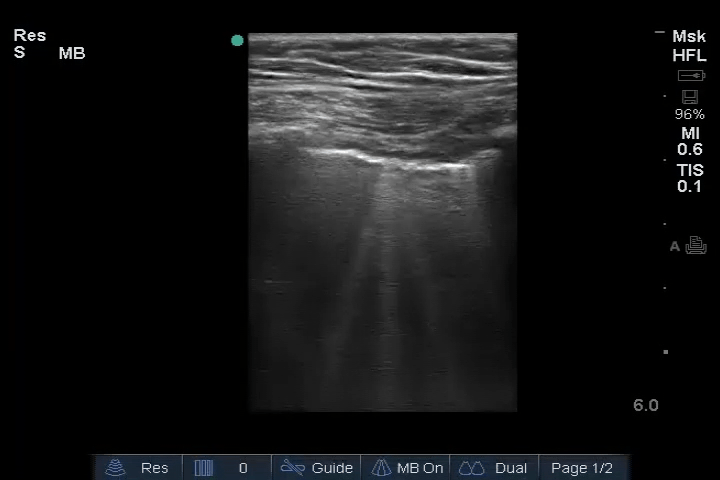 EEU case image missing